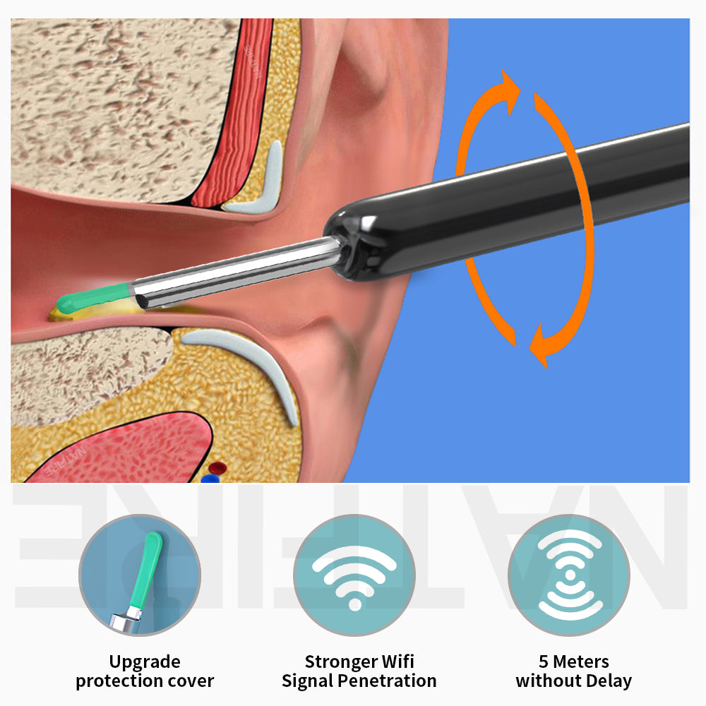 Reliable and Safe Ear Wax Cleaner Otoscope with HD Camera