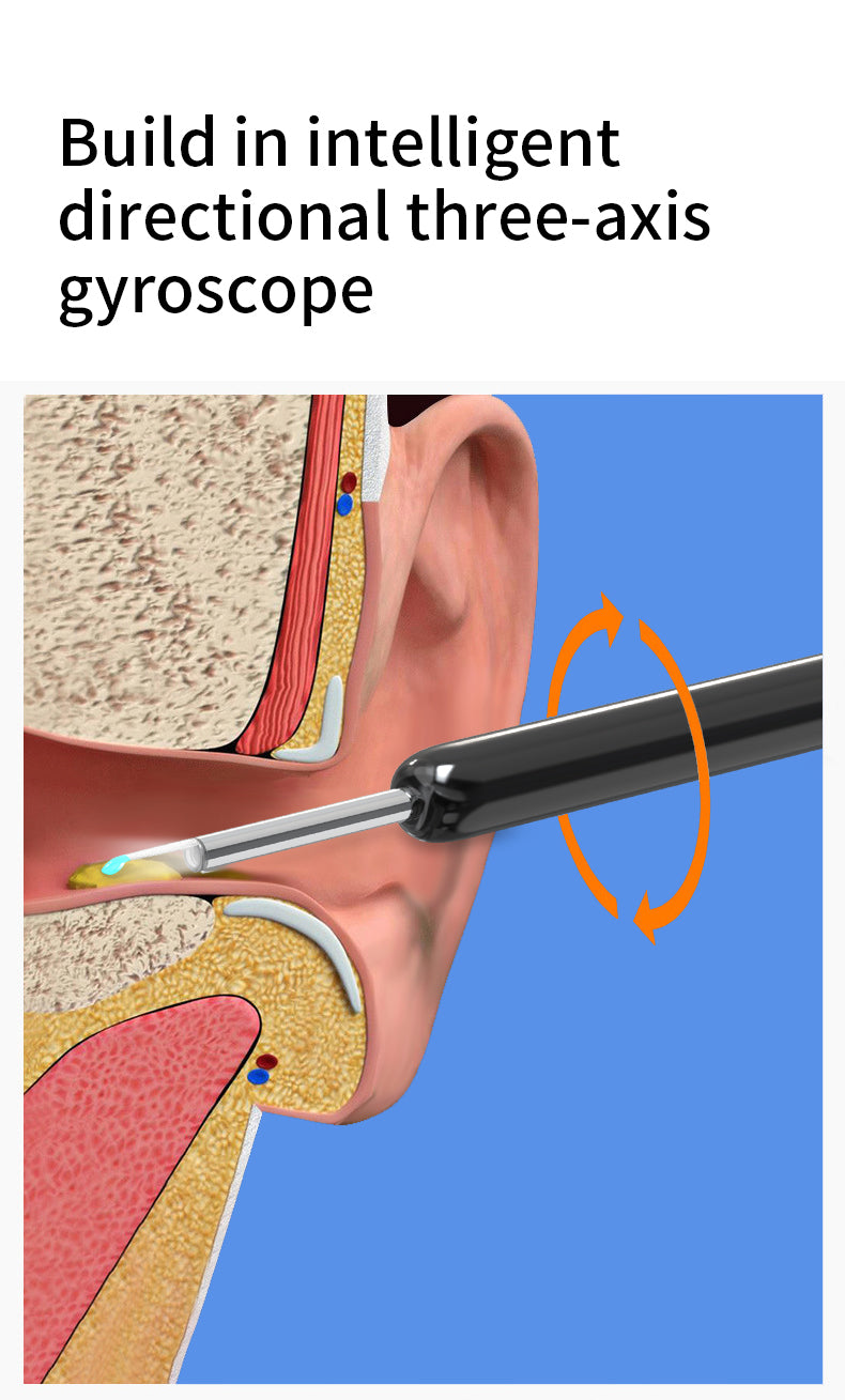 Reliable and Safe Ear Wax Cleaner Otoscope with HD Camera